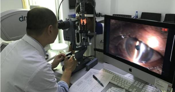 10月29日，一位职业性白内障男子，在厦门眼科中心手术后 复明。值得一提的，不少人对于其从事职业会导致的“职业性白内障”并不在意，但根据厦门眼科中心白内障专科陈伟主任介绍，在接诊中，职业性白内障并不少见，对于这些行业从业人员如何做好眼病防护，也进行了详细的介绍。.jpg