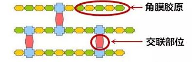 角膜胶原交联(Corneal Cross Linking，CCL)医治：使用370纳米波长的紫外线，激活核黄素(一种光敏感剂)，使其转化成活性氧族，活性氧族再诱导角膜胶原纤维的氨基之间发生化学交联反应，使角膜胶原纤维直径增粗、提*角膜基质对多种降解酶作用的抵抗力等多重生物学效应，从而使角膜基质的机械强度增加1.jpg