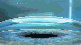 因为从手术原理来说，近视矫治手术是根据你需要 的近视度数，切削掉相应厚度的角膜，术后切削掉的角膜并不会再生长出来，所以，已经 的度数并不会复发1.png