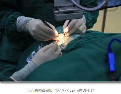 成都易游体育已经开展的青光眼手术有：引流阀 (钉)植入手术(2015年以来已200多 )，360°Schlemm's管切开术，激光CO2 辅助巩膜深层切除术，小梁切除术青(光眼)白(内障)联合手术。还有虹膜周切术、前房成形术、 虹膜复位术，睫状体冷冻术，小梁切开术和前房穿刺术等6.png