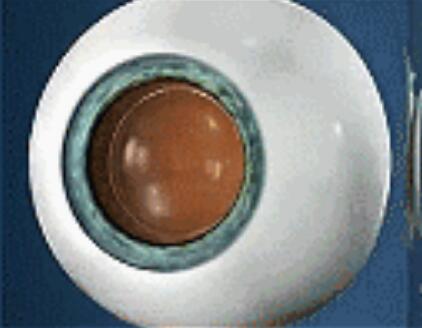 升学、征兵、公务员、就业，对于近视朋友而言，这些总是拦路虎……如今有多种近视 方法，想要摘镜，总有一款适合您.jpg