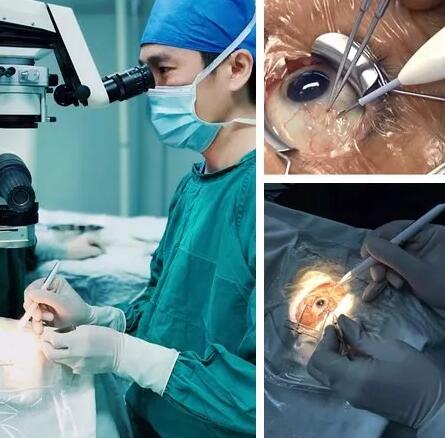 黄斑水肿是造成视网膜静脉阻塞患者低视力的主要原因，而炎症则是引起黄斑水肿的重要病理改变。所以控制炎症就能抑制黄斑水肿， 患者视力2.jpg