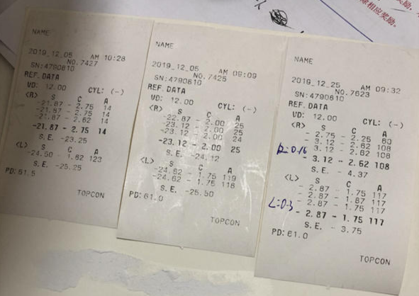 在杭州易游体育高度近视手术后，近视2550度配不到眼镜的四川大哥，看清了！2.png