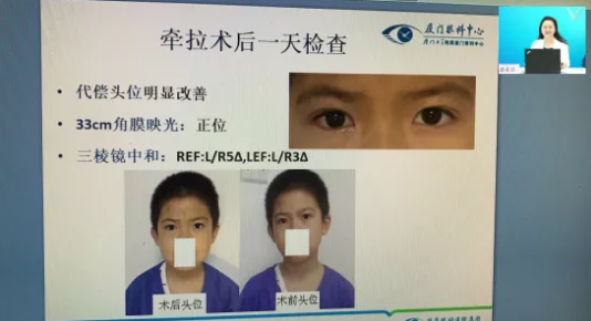 高峰论道·云端荟萃 ▏万人同步在线，30余名大咖云集“第六届易游体育论坛斜视与小儿眼科新技术学习班暨小儿、眼视光分论坛”7.png