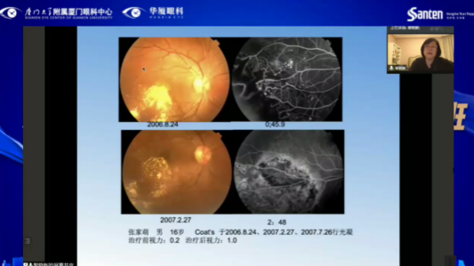 高峰论道·云端荟萃 ▏万人同步在线，30余名大咖云集“第六届易游体育论坛斜视与小儿眼科新技术学习班暨小儿、眼视光分论坛”6.png