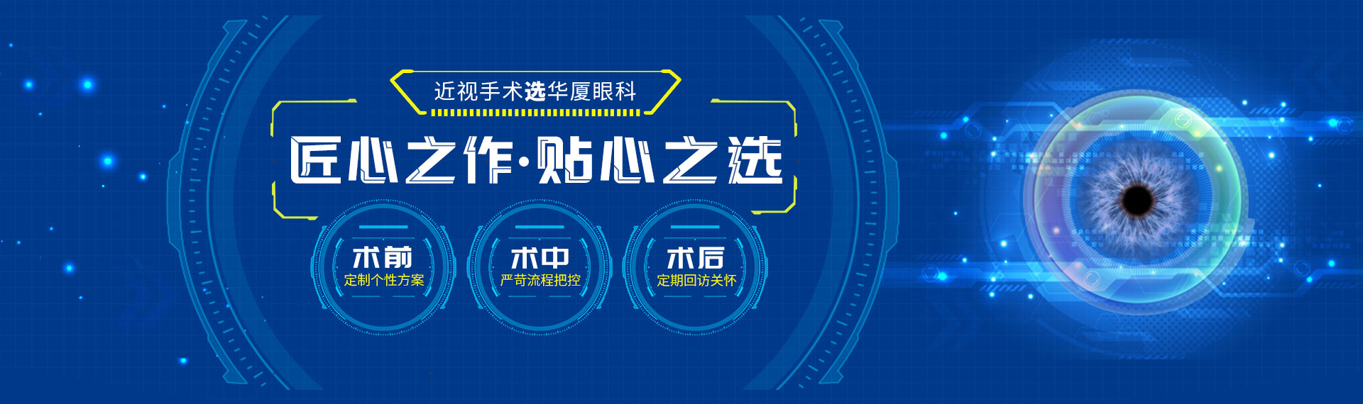 近视手术选易游体育